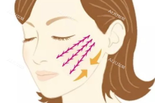 面部提升概念图 面部提升概念图
