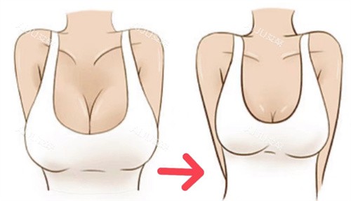 巨乳缩小卡通 巨乳缩小卡通