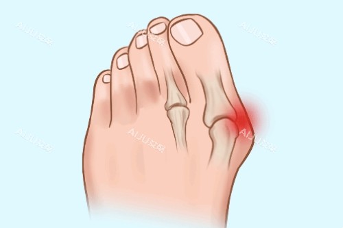 大脚骨疼痛卡通图