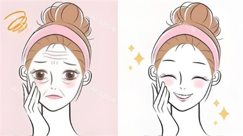 脸部抗衰对比 脸部抗衰对比