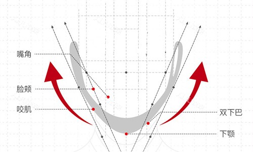 双颚手术的线条展示