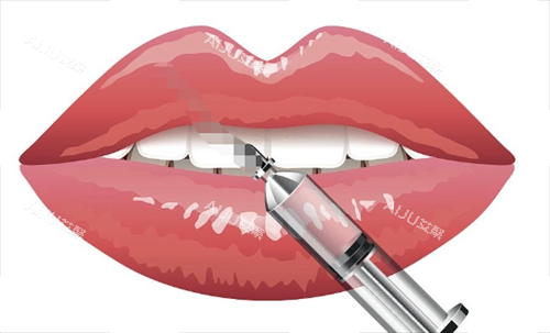 玻尿酸注射嘴巴动画展示