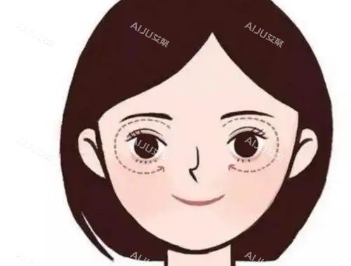 眼角下垂示意图