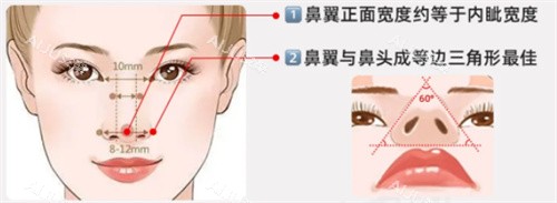 鼻翼缩小鼻翼图