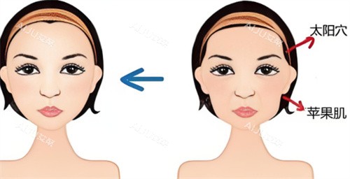 面部轮廓填充 面部轮廓填充