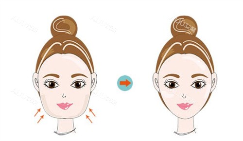 面部轮廓 面部轮廓