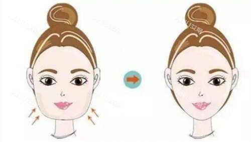 瘦脸***对比动画图 瘦脸***对比动画图