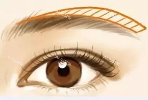 提眉位置卡通示意图 提眉位置卡通示意图