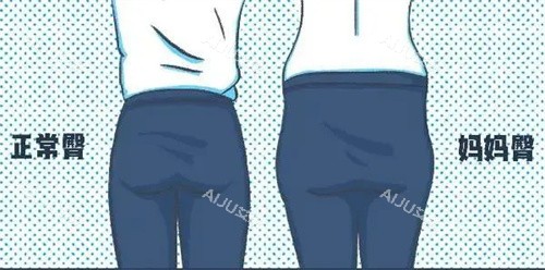 正常臀部和妈妈臀对比动画图 正常臀部和妈妈臀对比动画图