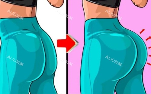 臀部填充前后示意图 臀部填充前后示意图