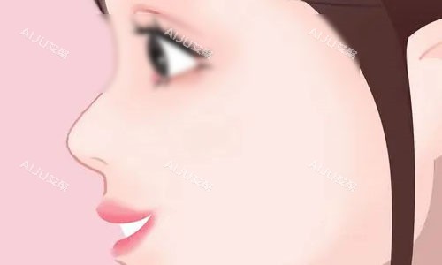 鼻根低平 鼻根低平