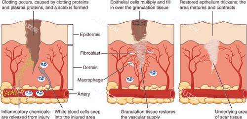 改善皮肤色素疤痕 改善皮肤色素疤痕