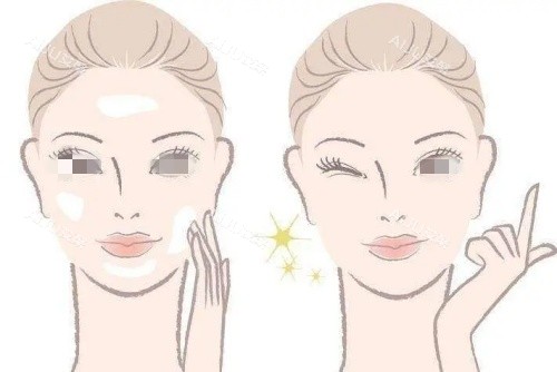 激光美白术后示意图_副本 激光美白术后示意图_副本