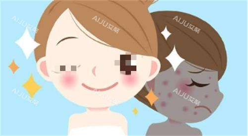 光子嫩肤成效图 光子嫩肤成效图