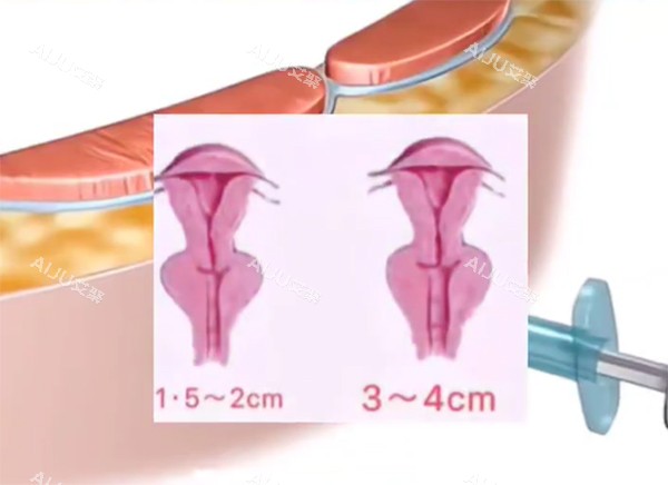 紧缩针对比动画***