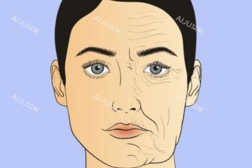 面部衰老提升卡通对比图