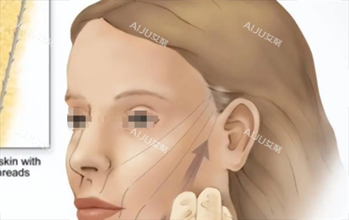 微拉美提升方向动画展示