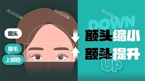 额头缩小和额头提升卡通