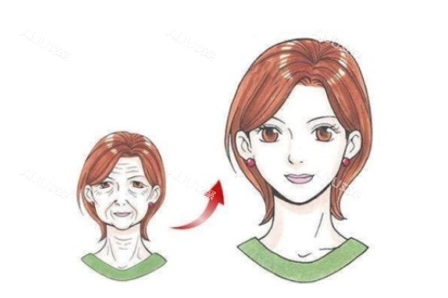 面部拉皮提升卡通对比图 面部拉皮提升卡通对比图