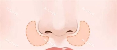 鼻基底鼻部展示图