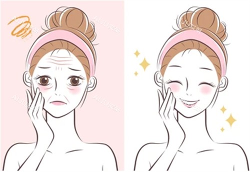 抗衰管理前后的对比图片 抗衰管理前后的对比图片