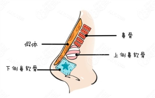 隆鼻动画解剖图