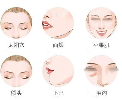 面部填充部位一览图