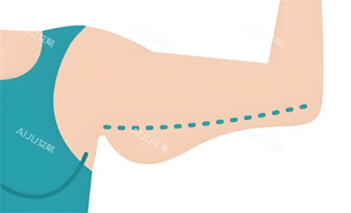 吸脂瘦手臂对比动画 吸脂瘦手臂对比动画