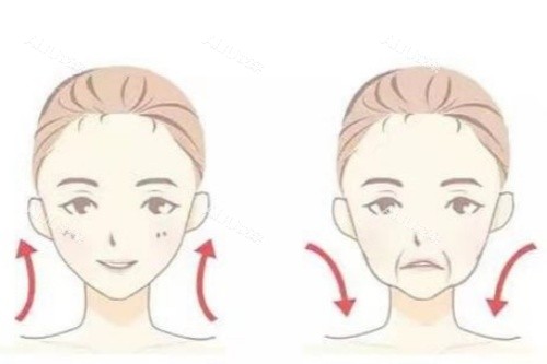 面部脂肪填充卡通对比图