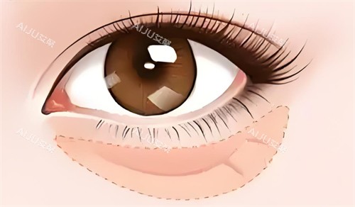 眼袋的位置卡通图