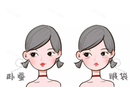 卧蚕、眼袋卡通对比图