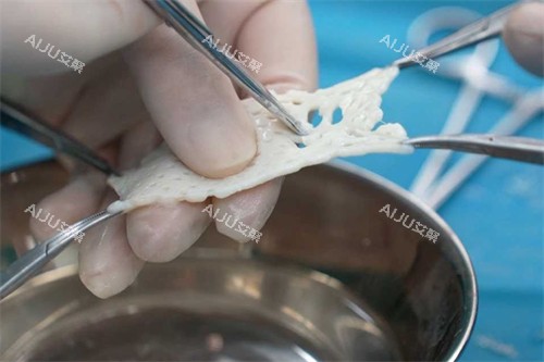 AMD生物补片图示