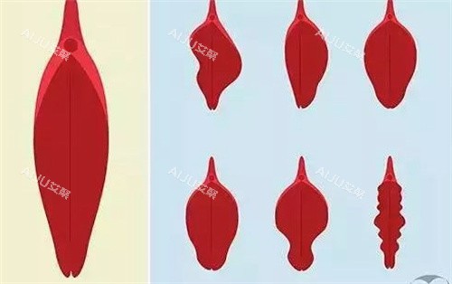 小阴唇的种类 小阴唇的种类