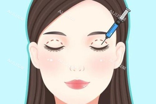 做双眼皮示意图 做双眼皮示意图