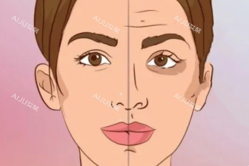 脸部做针剂提升卡通图