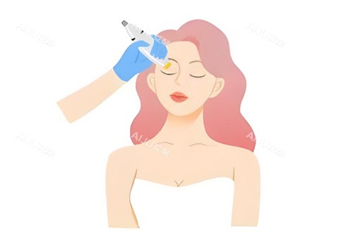 热玛吉操作图片