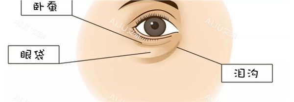 眼部卧蚕眼袋泪沟位置示意图
