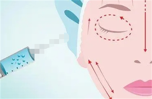 教你不同部位的玻尿酸怎么选择!上海乔雅登/伊婉/海薇等玻尿酸价格一览