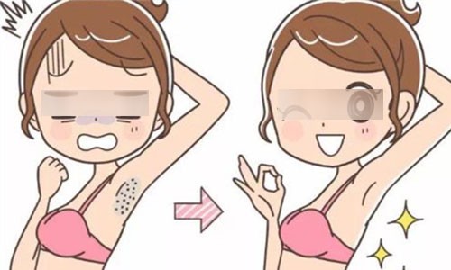 激光脱毛需要脱几次？是否持久有效？成效+价格+注意事项详细指南来袭
