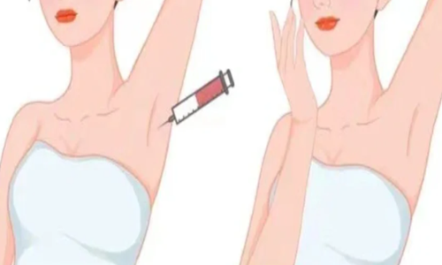 腋臭能直接祛除吗？除腋臭手术有哪些？看完这篇让你与腋臭做个了断