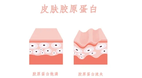 三型胶原蛋白有哪些品牌?五大品牌产品优势对比/维持时间/功效反馈/价格标准在线查