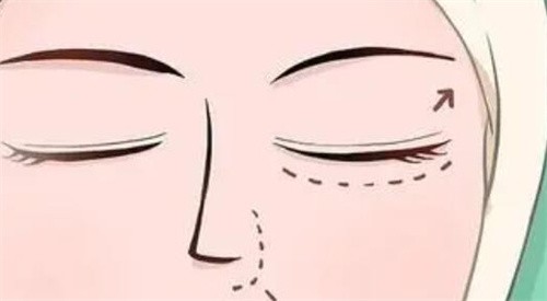 有问必答!双眼皮一万多和几千的区别:方案/审美/术后稳定性等多角度分析,附国内双眼皮好院名单