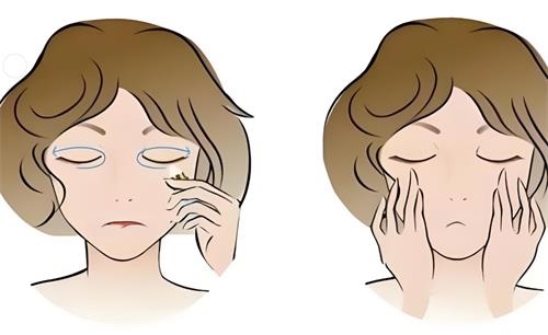 速看：正规医院去眼袋多少钱？能保持多久？一般在5000~10000元之间，可维持3~8年