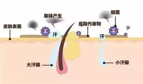 男生有狐臭怎么治疗更有效？结合狐臭味道大小进行药物、激光治疗、手术切除等治疗