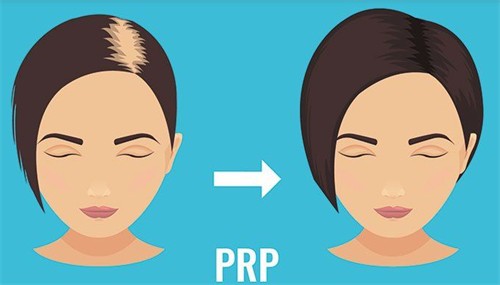 新乡植发口碑好的医院名单分享：新艺整形|亚星智美整形等医院植发技术好|服务好|成活率更高