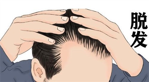 国内哪家植发医院种头发好？网友认可这几家植发正规医院技术对比很明显