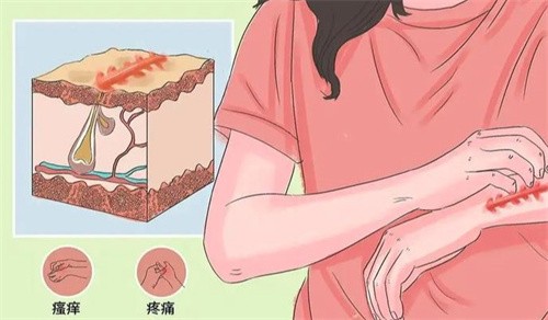 石家庄祛疤去哪家医院好？精选出石家庄修复剖腹产|凹陷|凸起疤痕好的医院名单