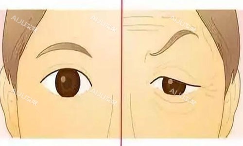 上眼皮下垂动画图片