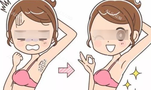 激光脱毛动画图