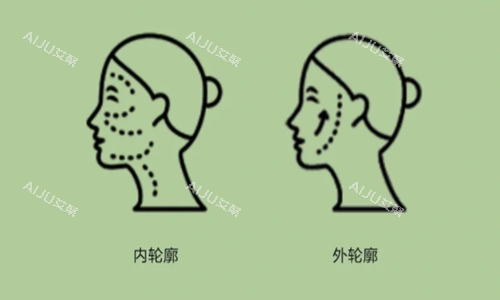 内外轮廓